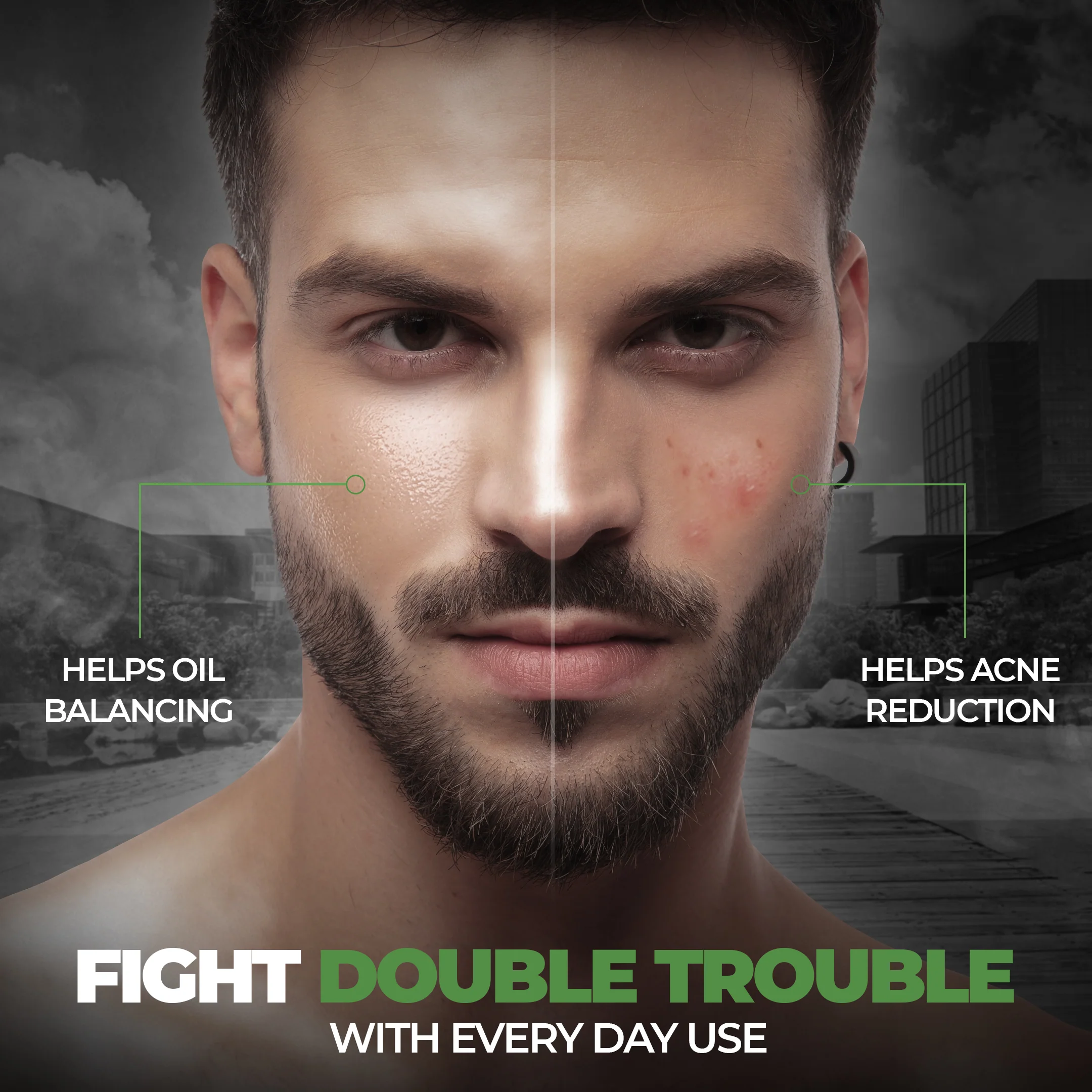 Acne Control combo - Image 21