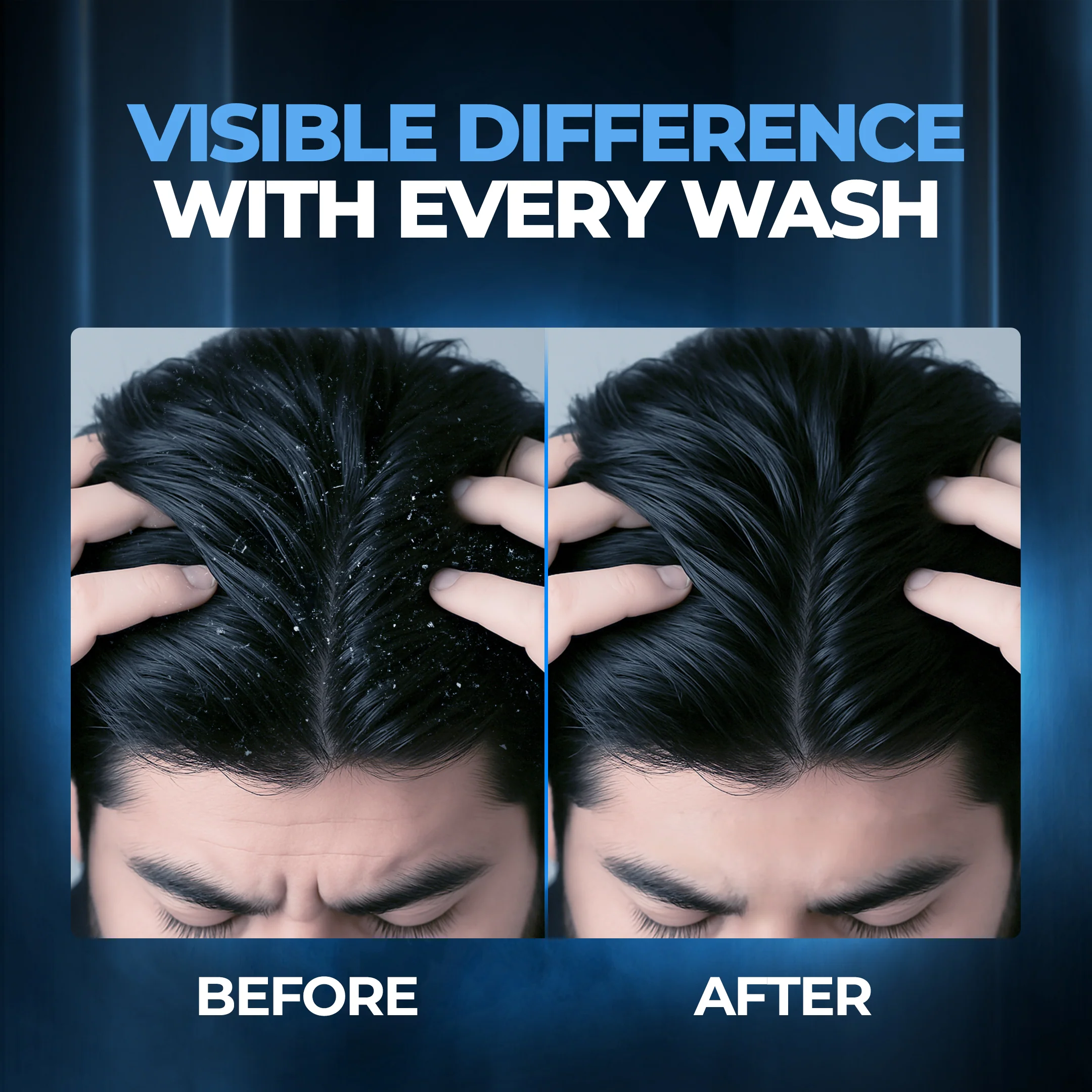 Dandruff Control Sulphate Free Shampoo - Image 4