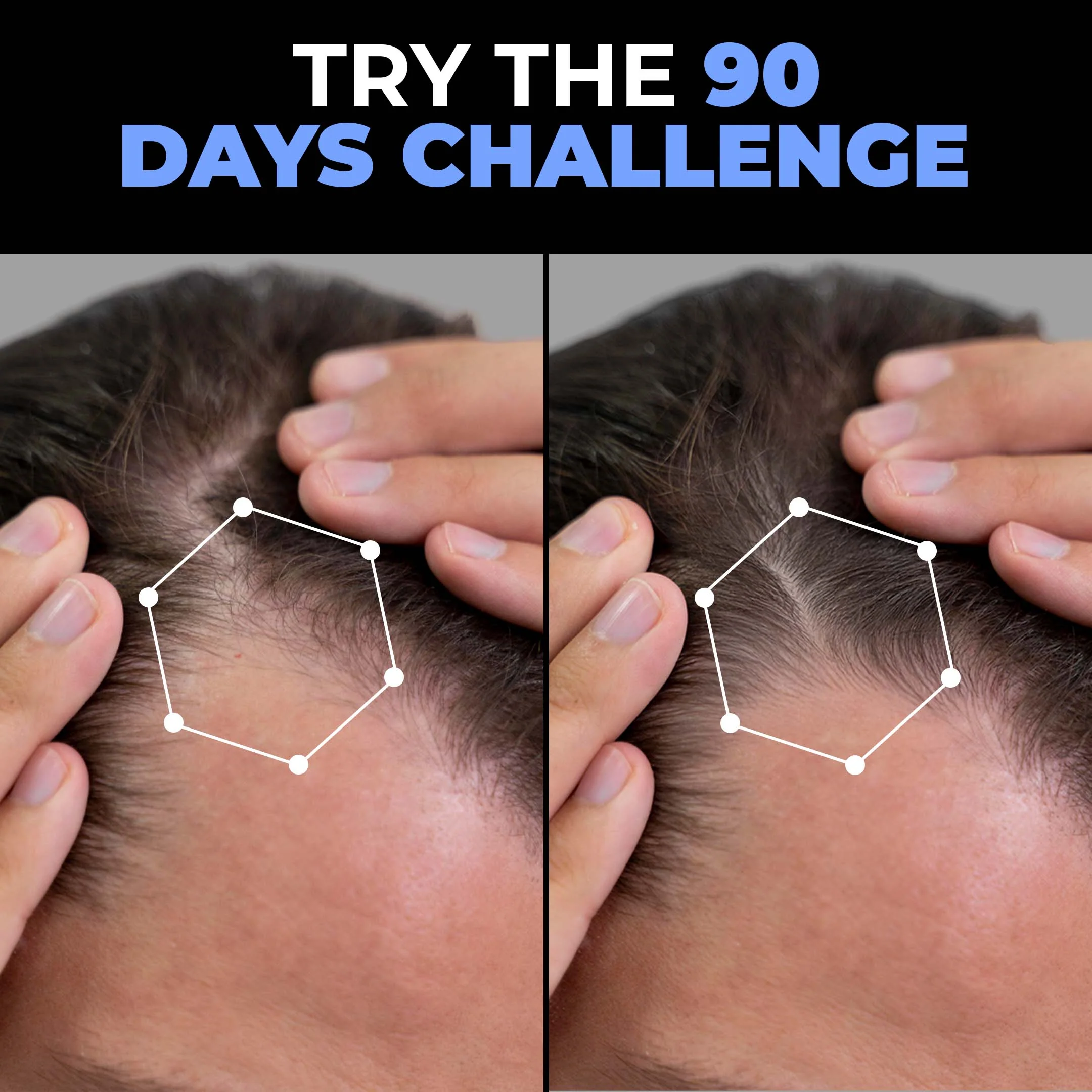 Hair Growth Regimen - Image 6
