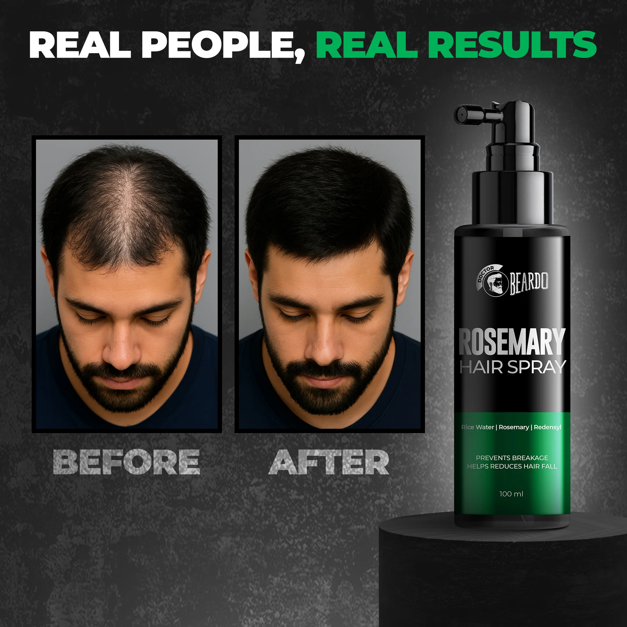 Rosemary Hair Spray (100ml) - Image 5